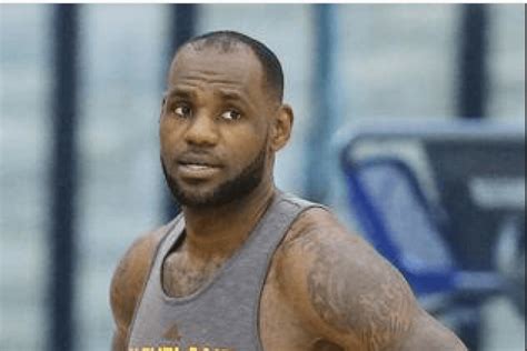 how did lebron james fix his hairline
